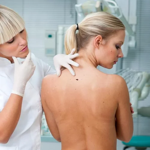 Δωρεάν δερματολογικός έλεγχος στο «Ερρίκος Ντυνάν» με αφορμή Ευρωπαϊκή Ημέρα Μελανώματος
