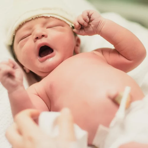 Μικροβίωμα του εντέρου στα μωρά: Ο τοκετός έχει σημασία!