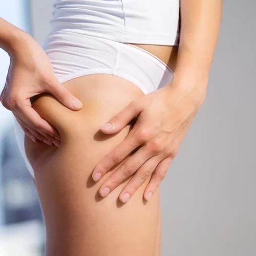 Υπάρχει θεραπεία για τοπικό πάχος και κυτταρίτιδα ακόμα και με μία μόνο επίσκεψη;