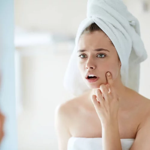 Η ιδανική beauty ρουτίνα για τη θεραπεία της ακμής