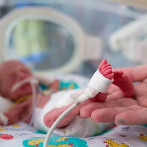 Πρόωρα μωρά: Μελέτη αποκάλυψε ποια γονίδια ευθύνονται και το ρόλο του σεληνίου