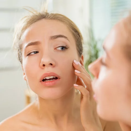 Ροδόχρους νόσος: Πώς θα απαλλαγείς από τα σπυράκια και τις κοκκινίλες;