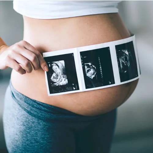 Εξωσωματική γονιμοποίηση: Τι είναι η Mini IVF και πότε προτείνεται;