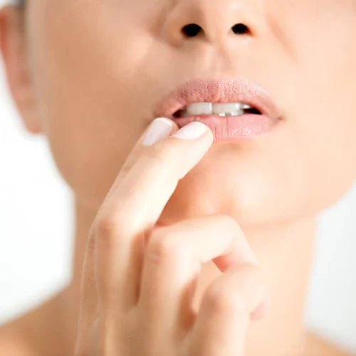 Επιχείλιος Έρπης: Οι εναλλακτικές θεραπείες που αξίζει να ξέρεις