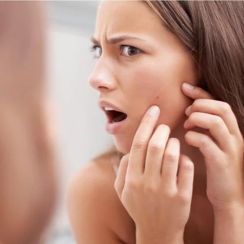 Μπορείς να σπάσεις σωστά ένα σπυράκι στο πρόσωπο;