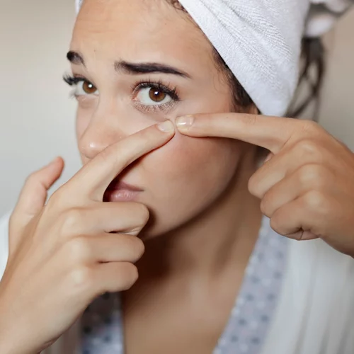 Κυστική ακμή: Ο πιο γρήγορος τρόπος να απαλλαγείς από τα επώδυνα σπυράκια