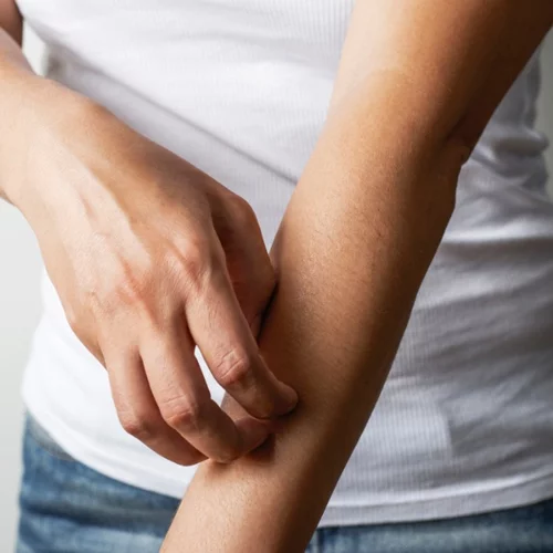 Πώς θα προστατευτείς από τον ιό του Δυτικού Νείλου