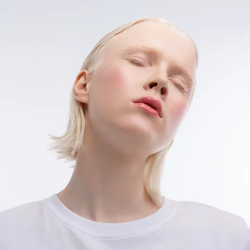 Τι είναι ο αλφισμός από τον οποίο πάσχει το μοντέλο Ανδριανή Ζαχάρη