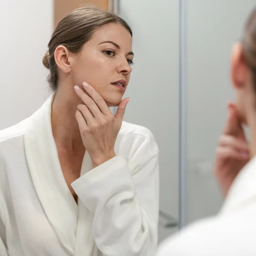 Συμβουλές για την ακμή: Καθαρή επιδερμίδα χωρίς σπυράκια με τις συμβουλές του δερματολόγου