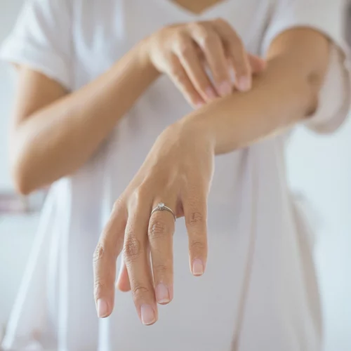 Update: Νέες θεραπείες για ψωρίαση και δερματικά νοσήματα και ψωρίαση