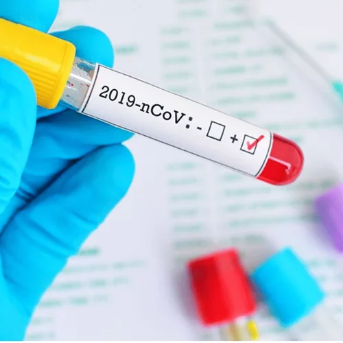 Κορονοϊός: Πέμπτος νεκρός στην Ελλάδα - Στα 387 έφτασαν τα κρούσματα