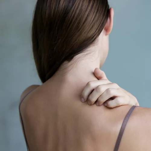 6 facts για την ψωρίαση από τη δερματολόγο