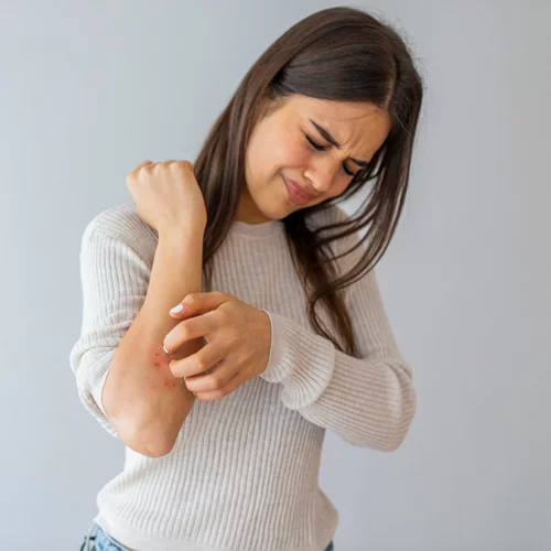 6 πράγματα που αξίζει να εξετάσεις αν η ψωρίασή σου δεν βελτιώνεται - συν μία νέα θεραπεία