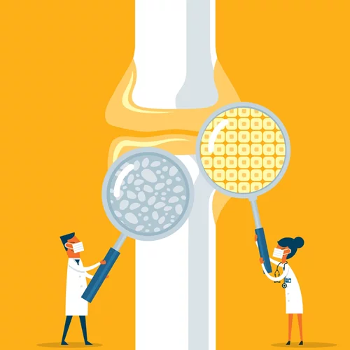 Ψωριασική αρθρίτιδα: Ποιες ηλικίες αφορά, τα συμπτώματα και η έγκριση μιας νέας θεραπείας που θα αλλάξει τα δεδομένα