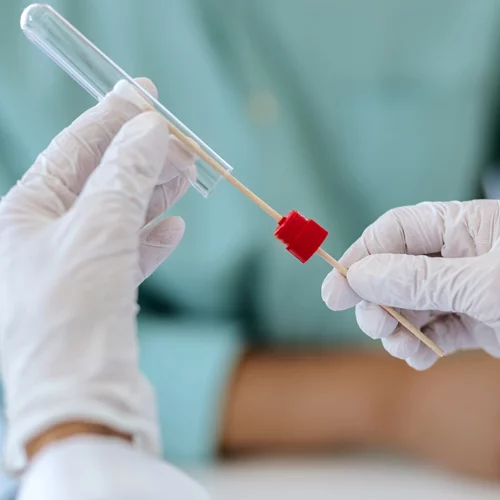 Μοριακό τεστ για κορονοϊό: Πιο πιθανό να βγει θετικό αν το κάνεις μετά το μεσημέρι!