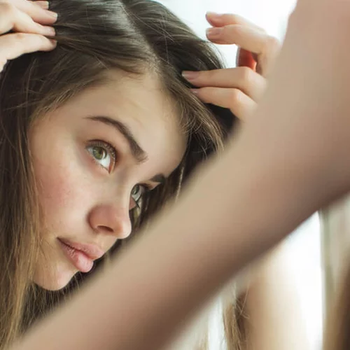 Πόσο συχνά να λούζω τα μαλλιά με πιτυρίδα; O μύθος που πρέπει να ξέρεις