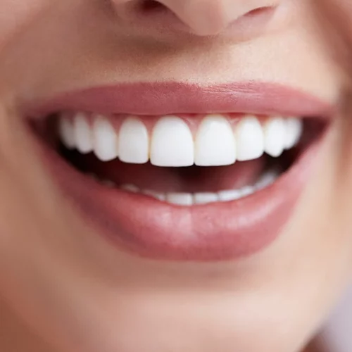 Το τέλος της κακοσμίας του στόματος