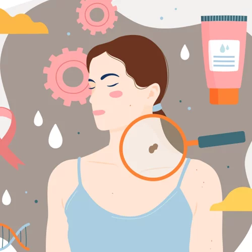 Το ΙΑΣΩ Γενική Κλινική ανακοίνωσε τη δωρεάν κλινική εκτίμηση σπίλων για την πρόληψη του καρκίνου του δέρματος