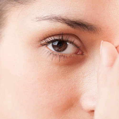 Όσα θέλεις να ξέρεις για την αποτρίχωση με κλωστή