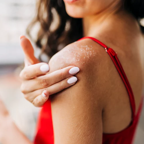 Κάηκες από τον ήλιο και ξεφλούδισες; Τι ΔΕΝ πρέπει να κάνεις;