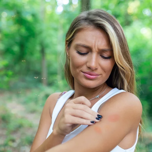 Είσαι "γλυκοαίματη"; Δοκίμασε αυτό για να απωθήσεις τα κουνούπια