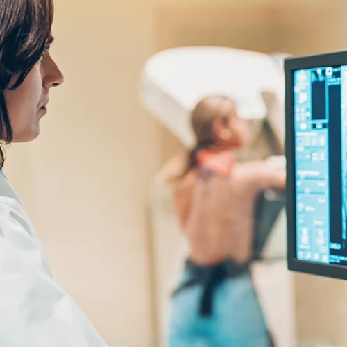 Καρκίνος του μαστού: Νέες κατευθυντήριες οδηγίες για την πρώτη μαστογραφία