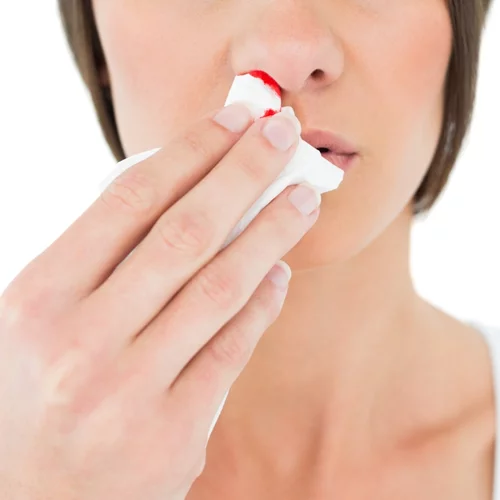 Τι να κάνεις αν ανοίξει η μύτη σου;