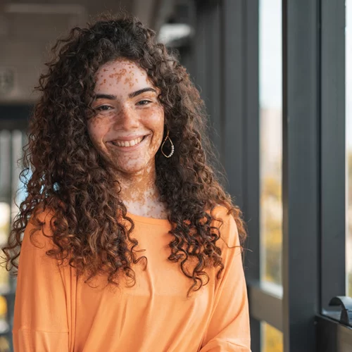 Λεύκη: Οι θεραπείες και το "κλειδί" για το σπάνιο αυτοάνοσο