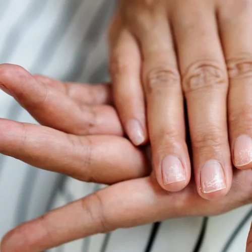 Η ανεπαίσθητη αλλαγή στο νύχι μίας 38χρονης που άλλαξε τα πάντα - Ο καρκίνος που κανείς δεν προέβλεψε