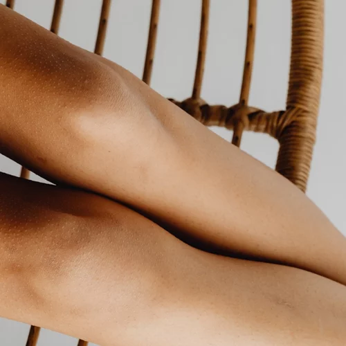 Γιατί έχεις πρησμένα πόδια και τι μπορείς να κάνεις;