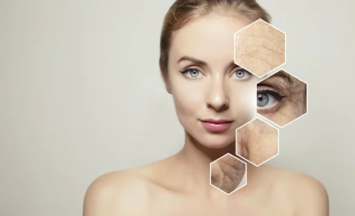 Ξέχνα τα fillers! Μάθε τα πάντα για τη βιοδιέγερση | Κάνει θαύματα στην επιδερμίδα