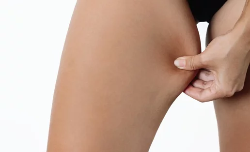 Εσωτερικό μηρών: Οι τροφές που συνδέονται με περισσότερο με λίπος στην περιοχή