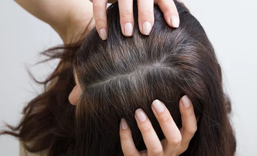 Επιστήμονες ανακαλύπτουν φυσική θεραπεία για τα γκρίζα μαλλιά – Το συστατικό που αποτρέπει το γκριζάρισμα + σε ποιες τροφές θα το βρεις!