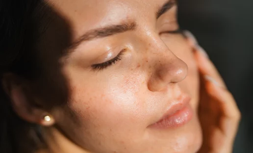 Χωρίς fillers: Το συστατικό που "γεμίζει" τις ρυτίδες εκ των έσω