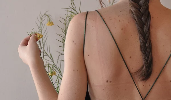 Οι χρόνιοι πόνοι είναι πραγματικοί ή "στο μυαλό" μας;