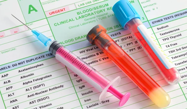 Νέα έρευνα: Η ομάδα αίματος δεν φαίνεται να επηρεάζει την πιθανότητα λοίμωξης ή τη σοβαρότητα της Covid-19