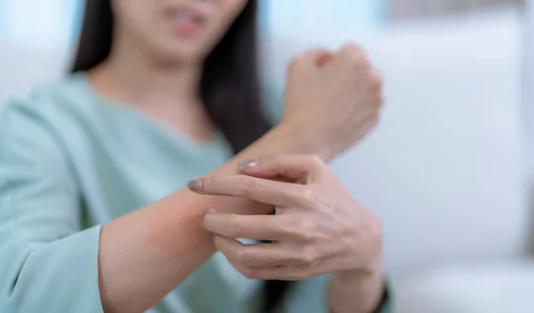 Πώς θα φτιάξεις φυσικό αντικουνουπικό - Eύκολο, αποτελεσματικό και ασφαλές