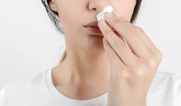 Πώς σταματάς τη ρινορραγία | Φέρνεις το κεφάλι μπροστά ή πίσω;