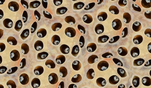 Τι είναι η τρυποφοβία;