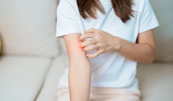 Έχεις λύκο (ΣΕΛ); Δες γιατί τα συμπτώματα μπορεί να βελτιωθούν φυσικά με το πέρασμα του χρόνου