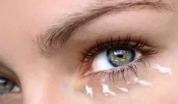 Ταλαιπωρείσαι από μαύρους κύκλους στα μάτια; Ο εύκολος τρόπος για να απαλλαχθείς από αυτούς μια και καλή