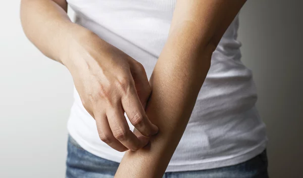 Ιός Δυτικού Νείλου: Τι να προσέχεις σύμφωνα με τον καθηγητή Τζανάκη