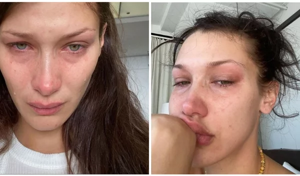 Η Bella Hadid ξεσπά: "Τα μέσα κοινωνικής δικτύωσης δεν δείχνουν ποτέ όλη την αλήθεια"