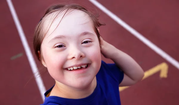 Σύνδρομο Down: Ποιοι είναι οι τρεις τύποι του; Πώς ανιχνεύεται