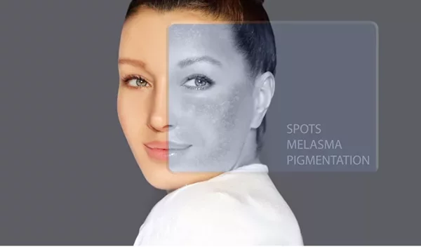 Ποιος φοβάται τις κηλίδες; Όχι εγώ!