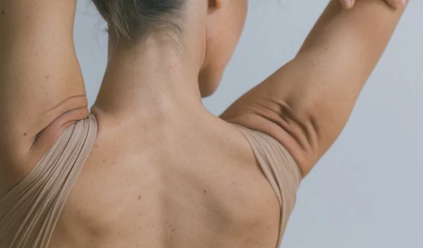 Ραγάδες στους ώμους: Τι τις προκαλεί και πώς να τις αντιμετωπίσεις;