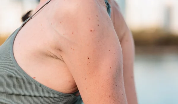 Κυρτοί ώμοι: Ίσιωσε την πλάτη με αυτές τις ασκήσεις από τη Χριστίνα Μαυρίδου