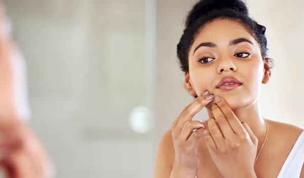 Τα μικρά άσπρα σπυράκια στο πρόσωπό σου δεν είναι (ακριβώς) ακμή