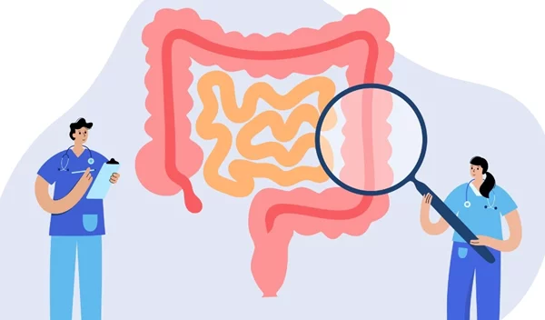 Τι είναι το self test για τον καρκίνο του εντέρου και πώς λειτουργεί