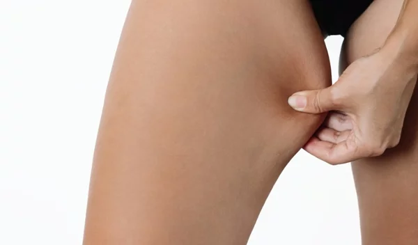 Εσωτερικό μηρών: Οι τροφές που συνδέονται με περισσότερο με λίπος στην περιοχή